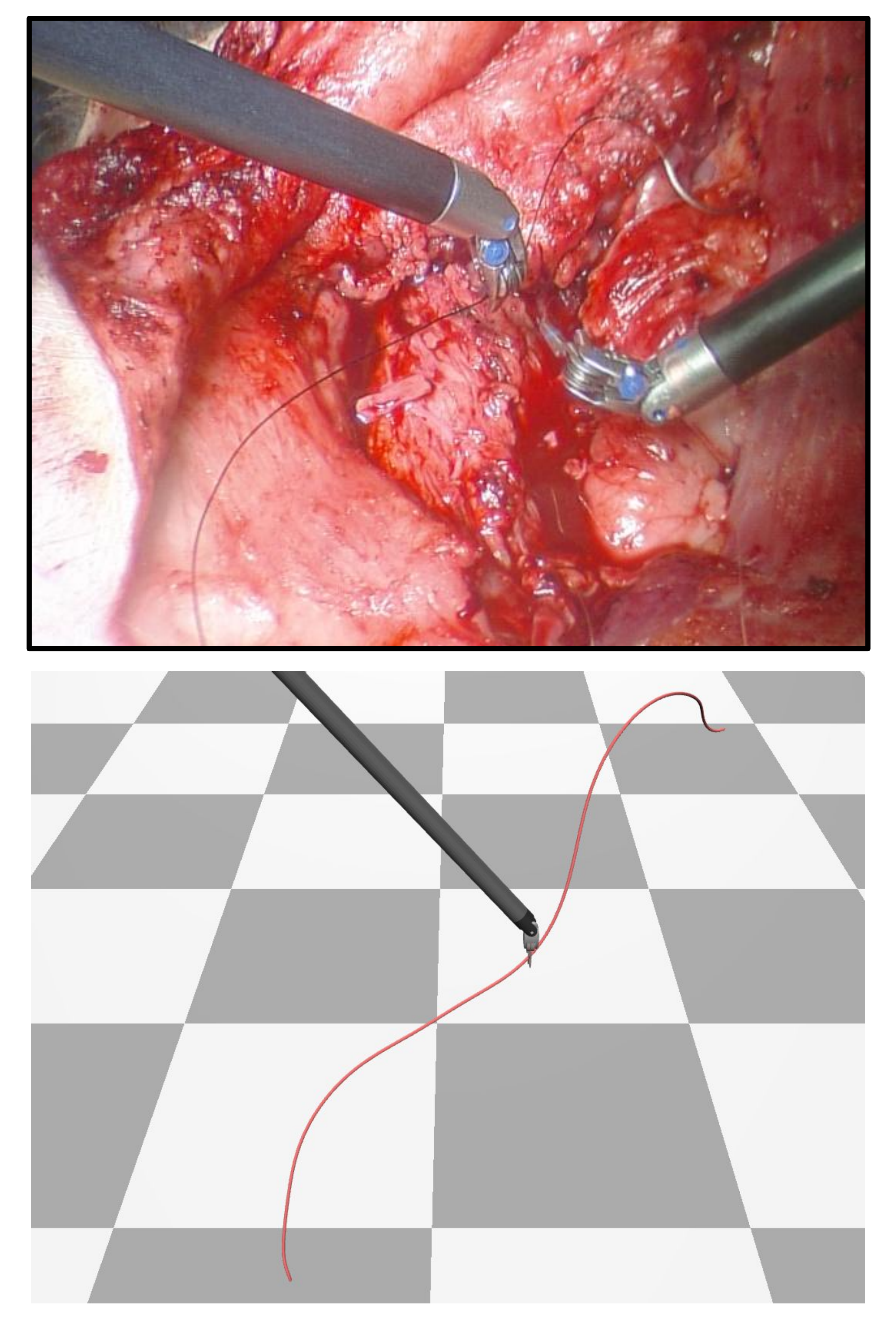 suture1.png