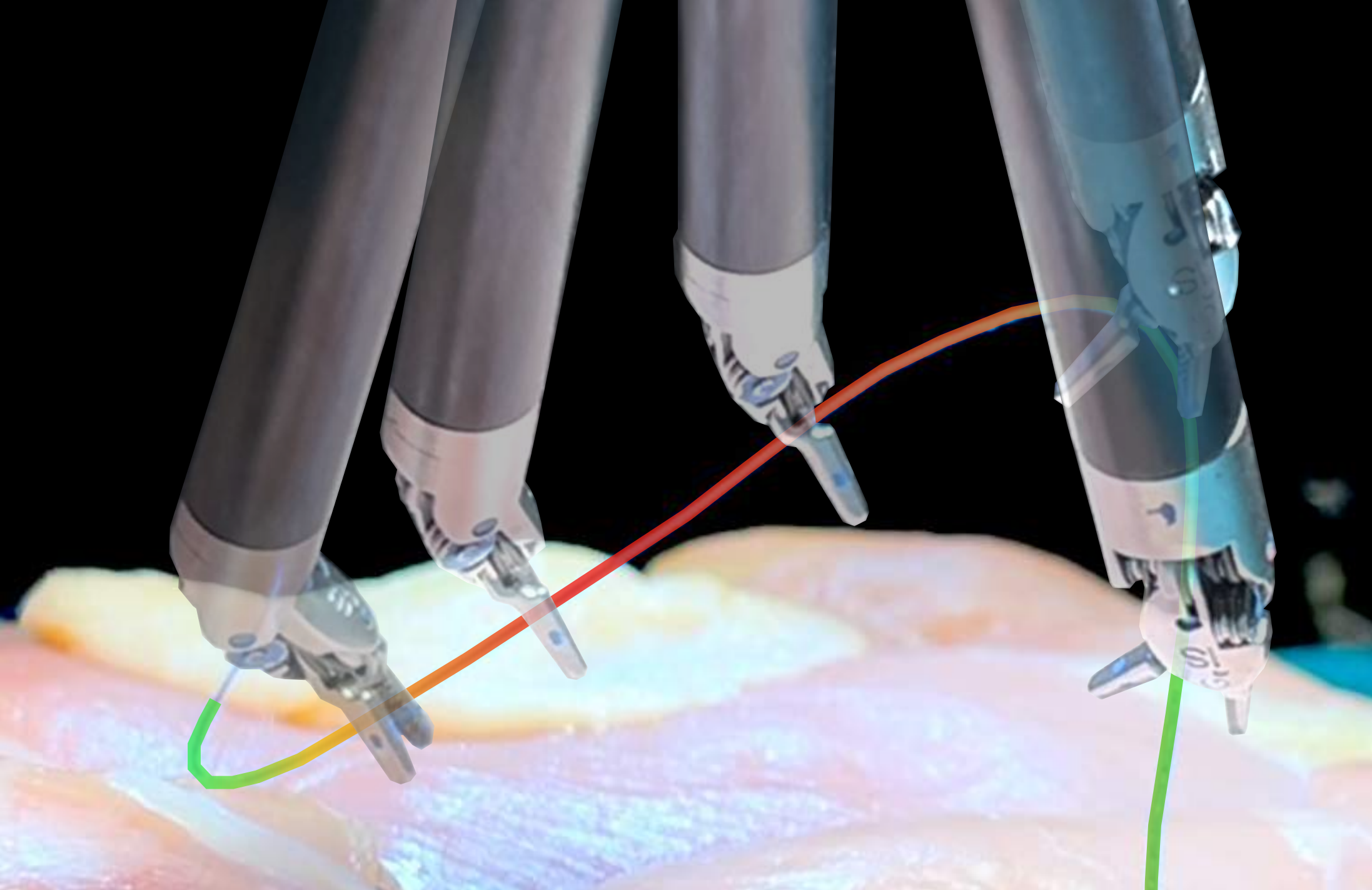 suture2.png
